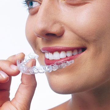 Invisalign
